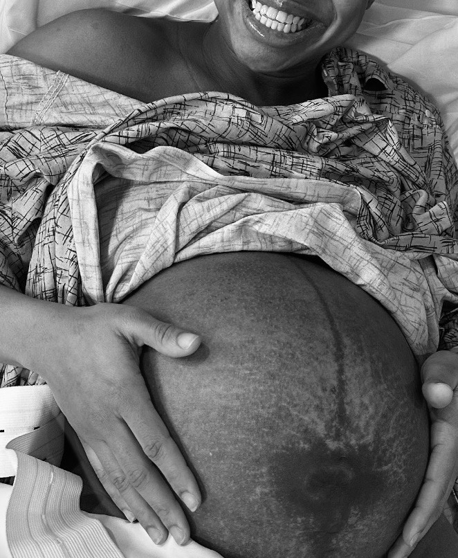 Person smiling, lying in bed, holding their pregnant belly with both hands, wearing a patterned shirt, in black and white.