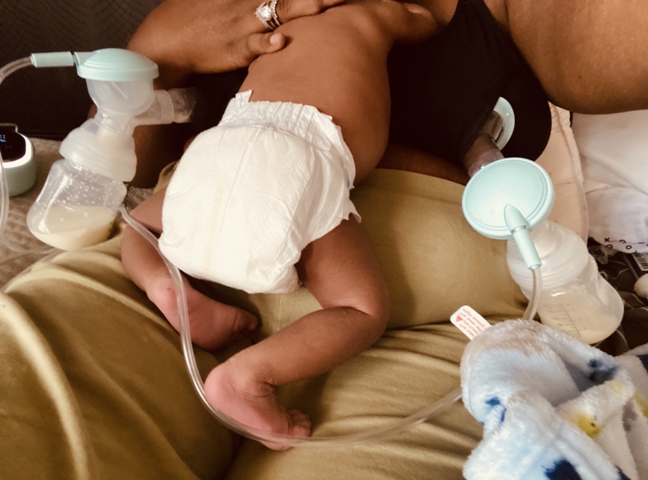 Baby lying on adult's lap, wearing a diaper, surrounded by medical equipment, in a hospital setting.