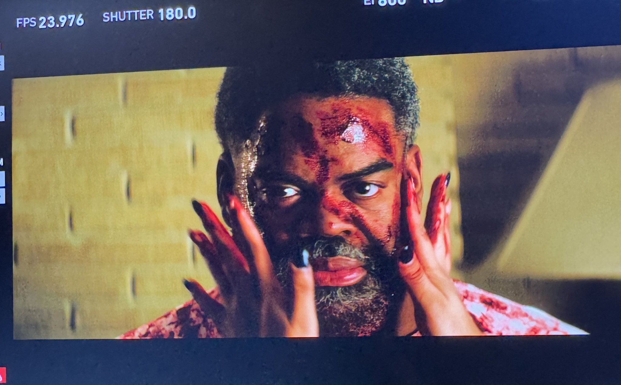 Person with blood on face and hands, holding face with both hands, in front of yellow brick wall.
