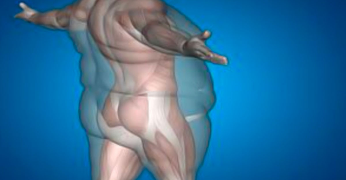 Multiple overlapping semi-transparent images of a person's torso and arms against a blue background.