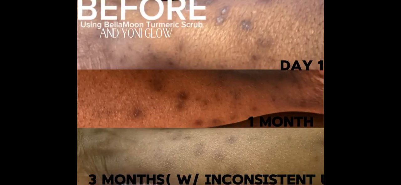 Three skin images showing progress over time: day 1, one month, three months with inconsistent results.