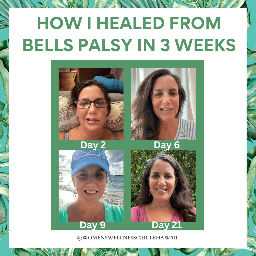 Collage showing four photos of a woman at different days, with text about healing from Bell's Palsy in three weeks.